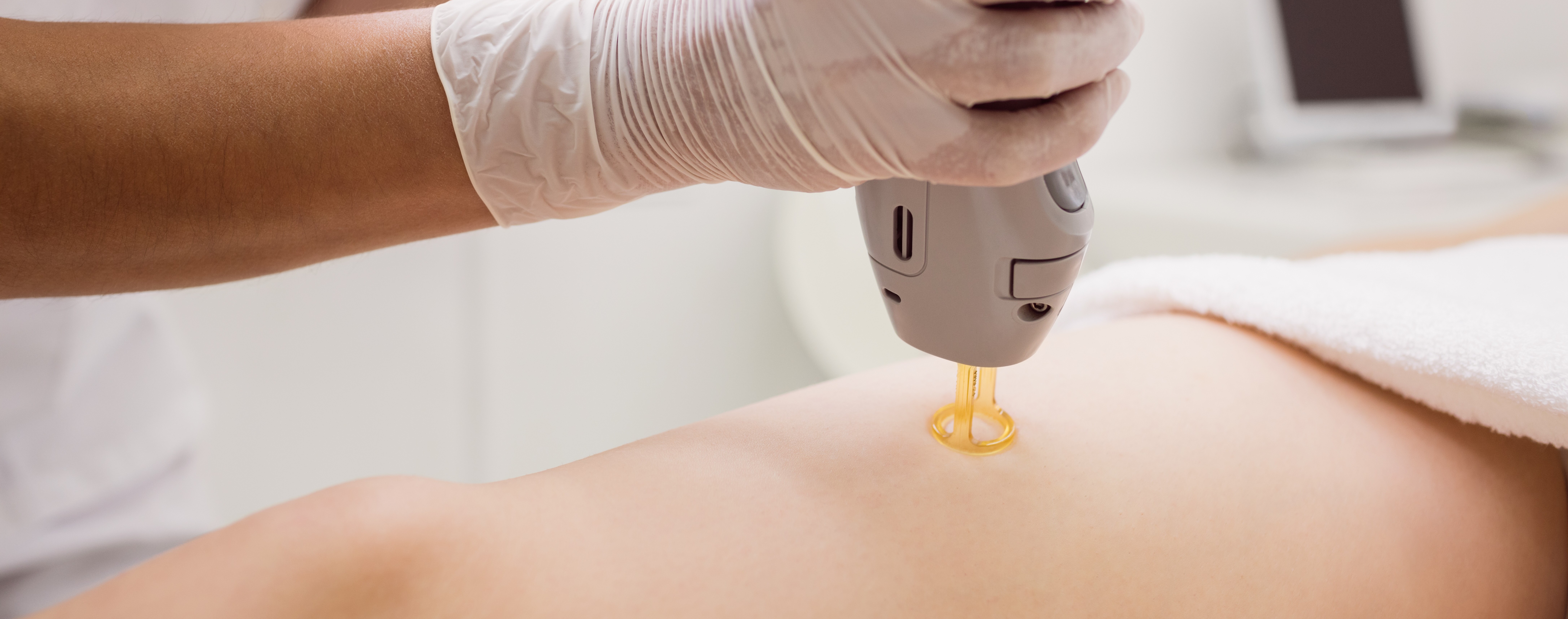 Benefits of laser hair removal for smooth skin
